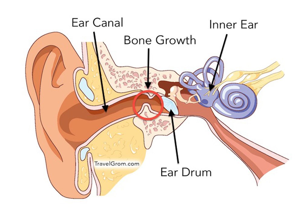 surfers ear picture diagram